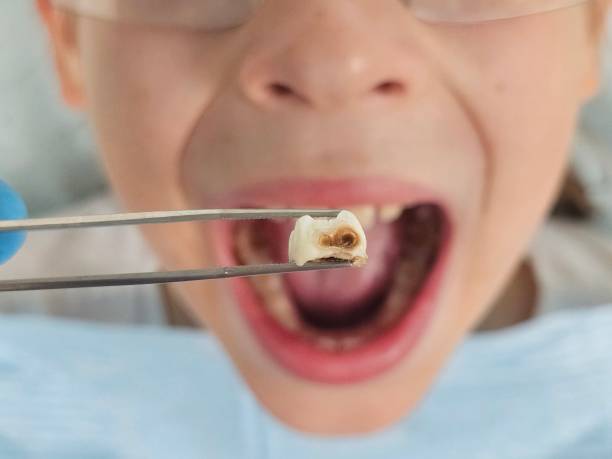 Best Cracked Tooth Emergency Dentist  in Ardia, CA